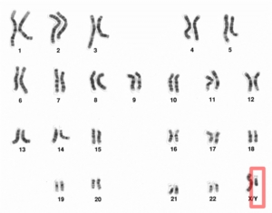 ヒト（男性）の染色体構造におけるY染色体
